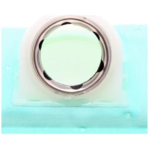 Precision Fuel Pump Strainer – S13074 - view 2